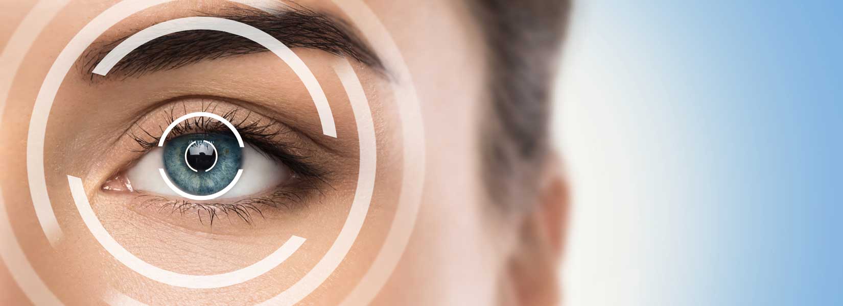 LASIK & Refractive Surgery Co-Management in Holly Springs